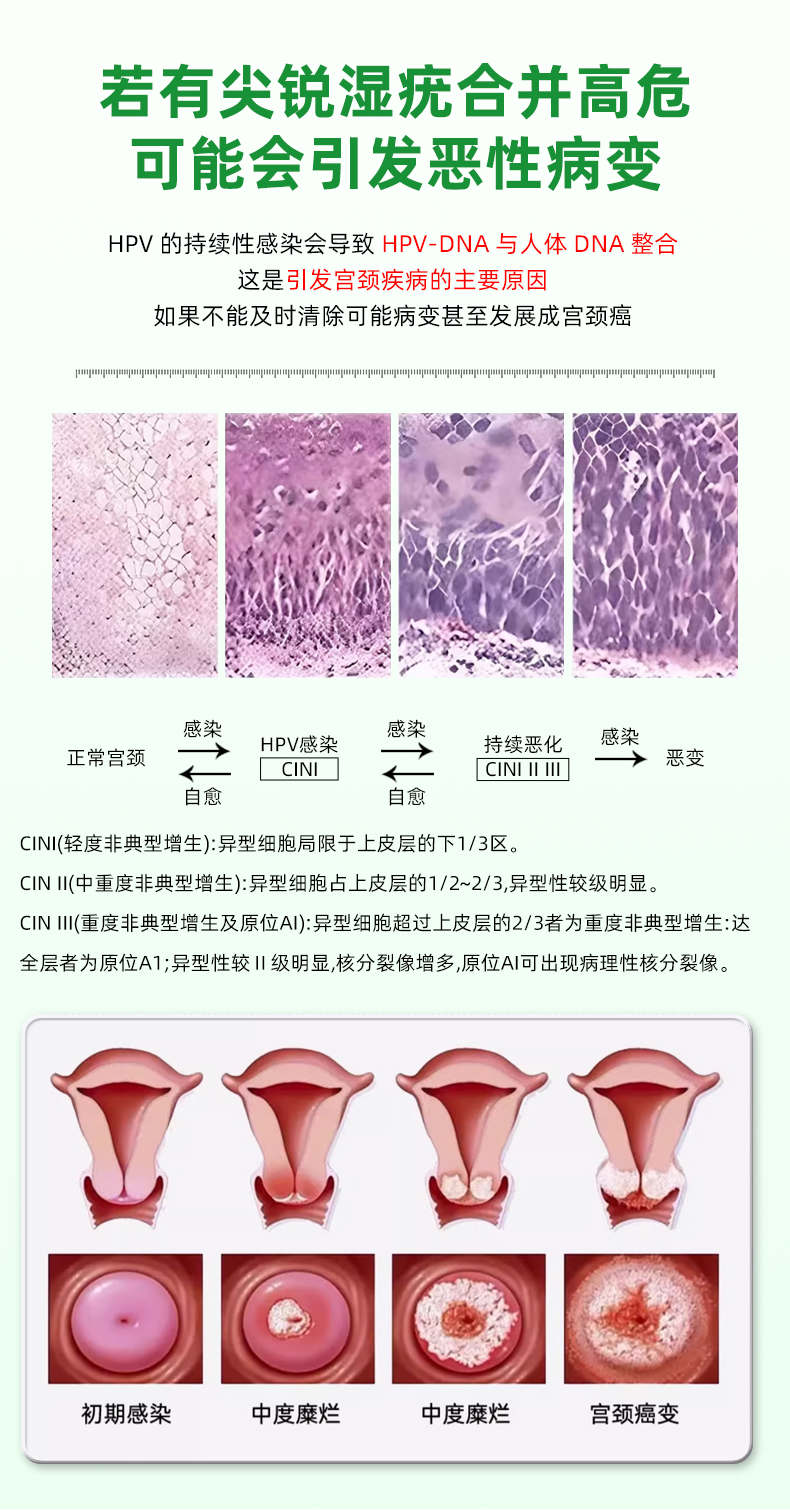 醋酸白详情绿色风格-20251223_06.jpg