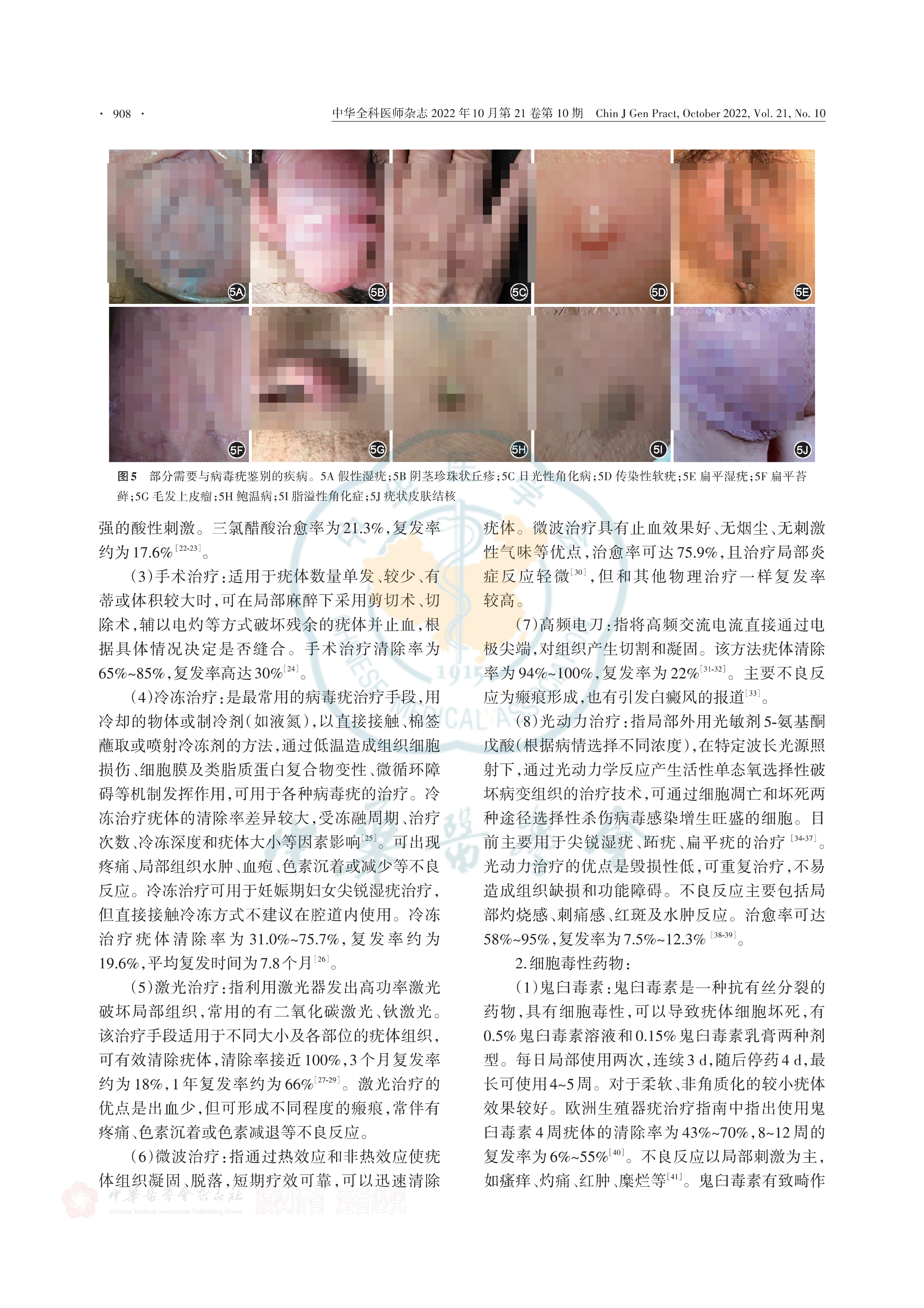 病毒疣基层诊疗指南（2022年）-5.png