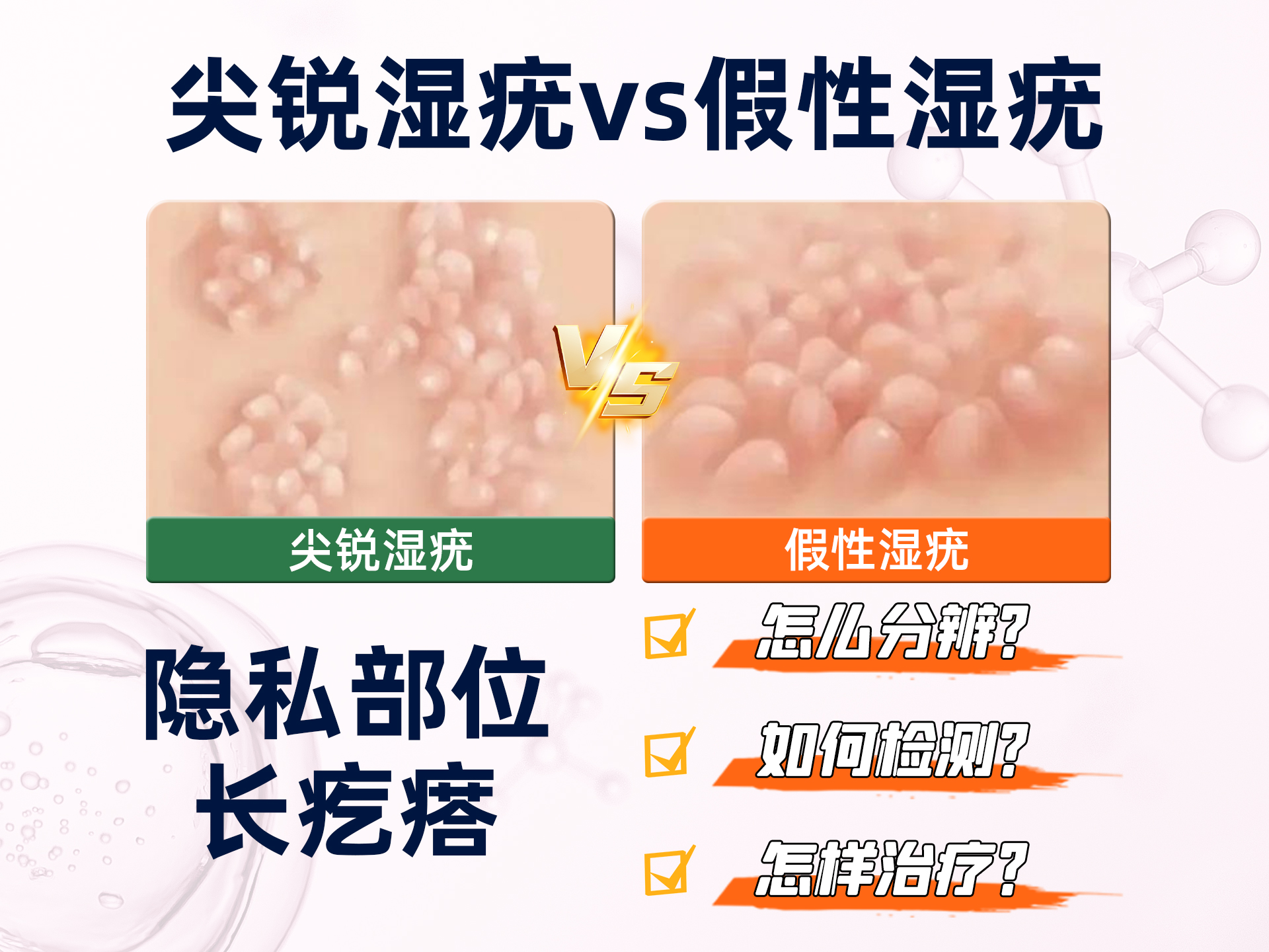 尖锐湿疣和假性湿疣的区别