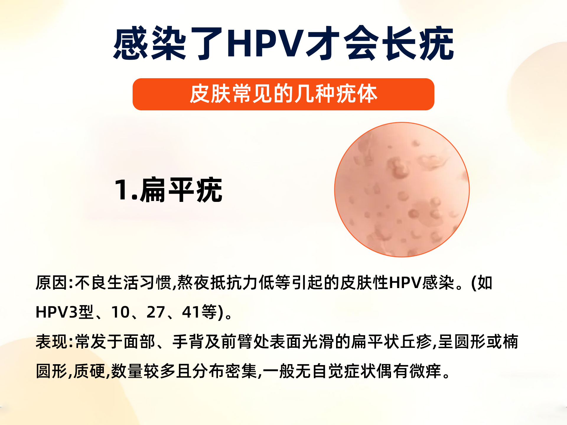 常见的几种皮肤病疣体