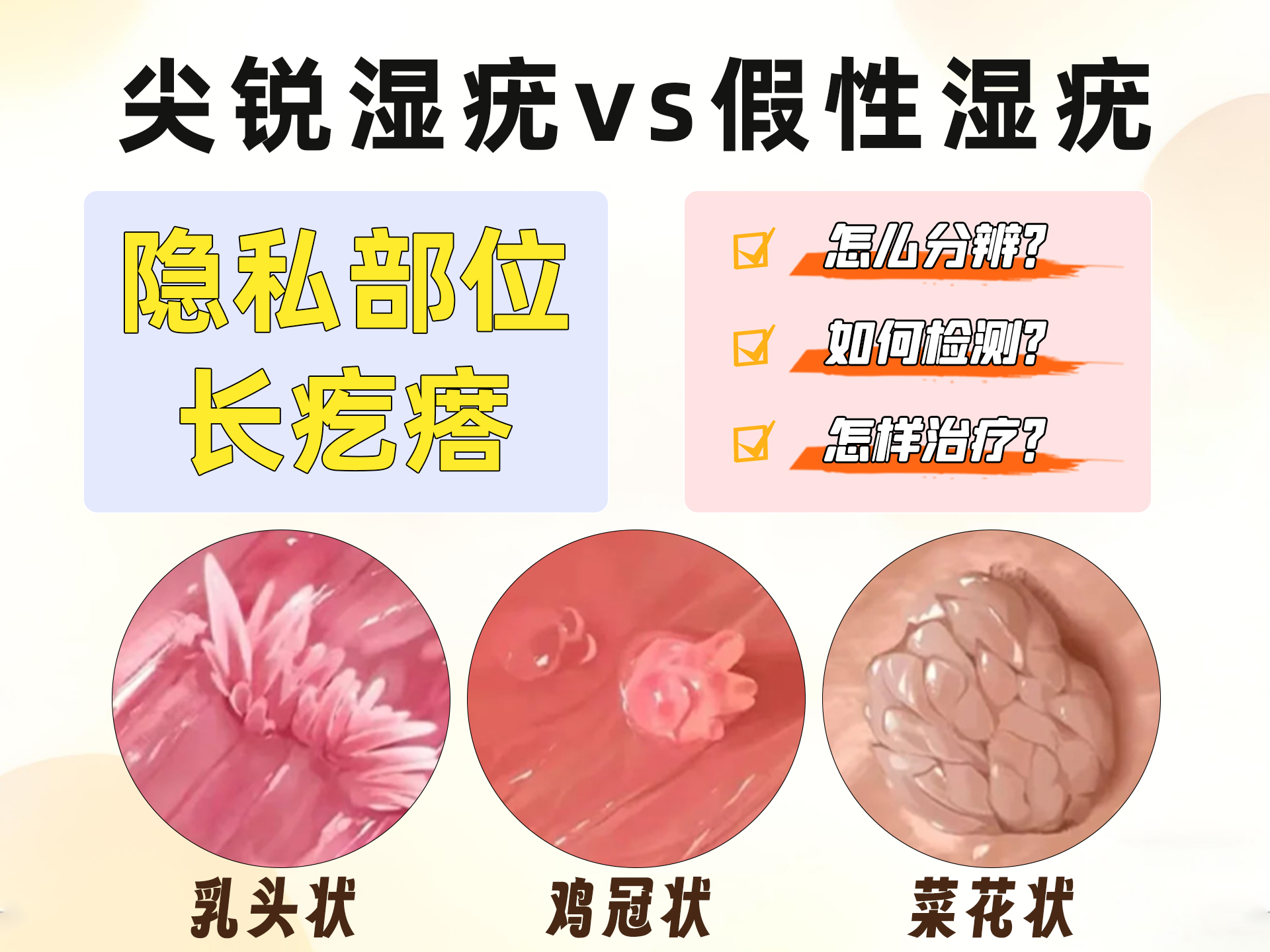 尖锐湿疣 vs 假性湿疣：一键分辨，科学自检不慌张